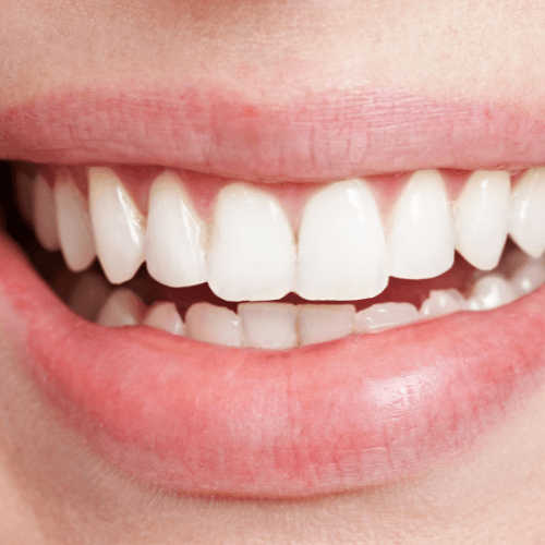 Les 5 erreurs à éviter pour garder des dents blanches naturellement